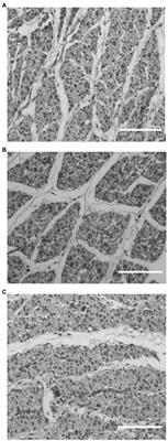 Histological Analysis and Gene Expression of Satellite Cell Markers in the Pectoralis Major Muscle in Broiler Lines Divergently Selected for Percent 4-Day Breast Yield